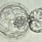 Blastocyst Embryo Transfer