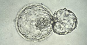 Blastocyst Embryo Transfer