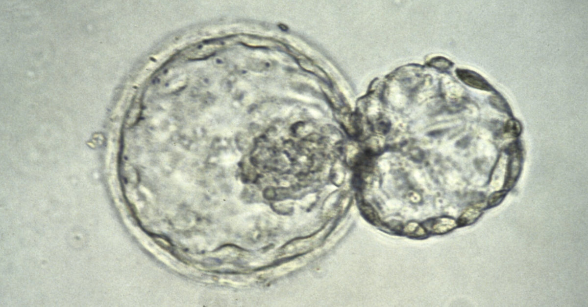 Blastocyst Embryo Transfer